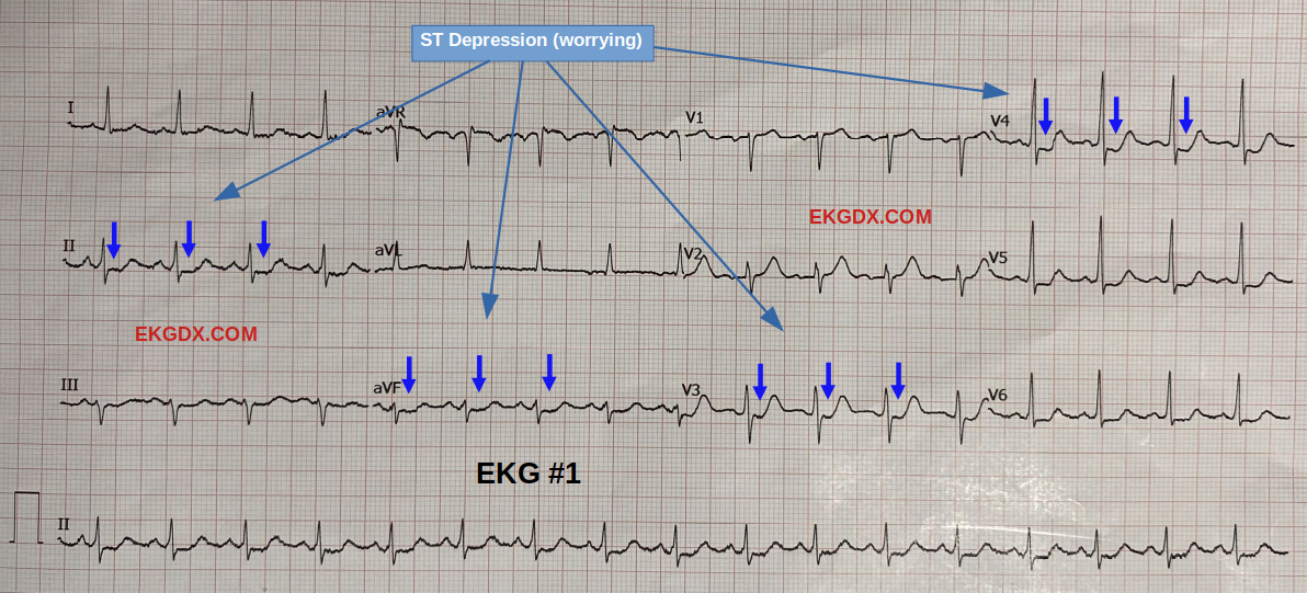 EKGDX - The new era of EKG learning